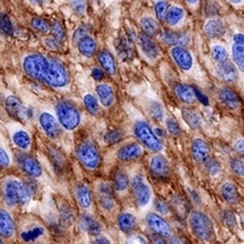 CD141 Rabbit Monoclonal Antibody