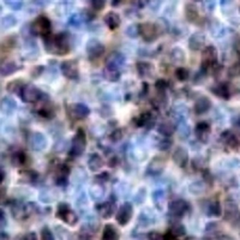 TCL-1A Rabbit Monoclonal Antibody