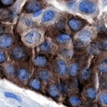 TAU Rabbit Monoclonal Antibody