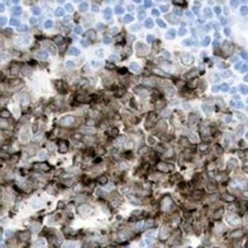 STMN1 Rabbit Monoclonal Antibody