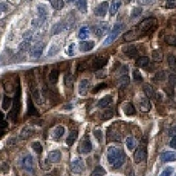STAT5A Rabbit Monoclonal Antibody