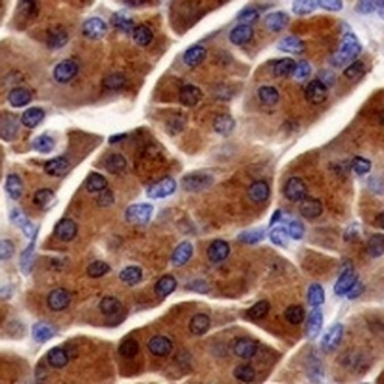 SPINK1 Rabbit Monoclonal Antibody