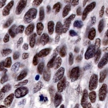 SOX10 Rabbit Monoclonal Antibody