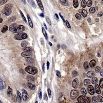 SMAD4 Rabbit Monoclonal Antibody