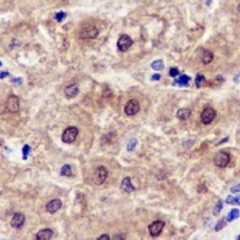 SETBP1 Rabbit Monoclonal Antibody