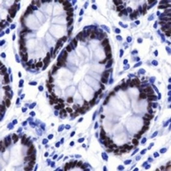 SATB2 Rabbit Monoclonal Antibody