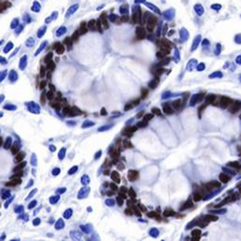 SATB2 Rabbit Monoclonal Antibody