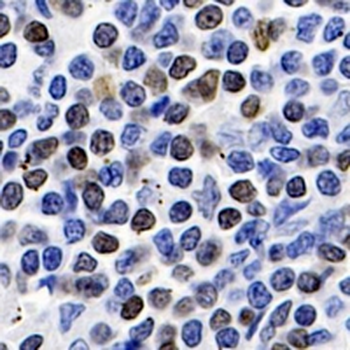 SATB1 Rabbit Monoclonal Antibody