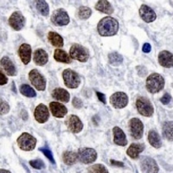 SALL4 Rabbit Monoclonal Antibody