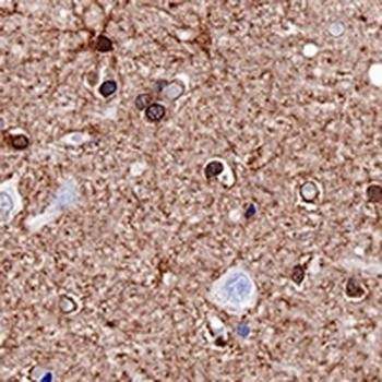 S100-B Rabbit Monoclonal Antibody
