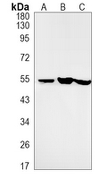 PTEN Rabbit Monoclonal Antibody