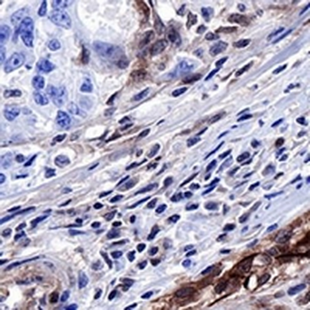 PTEN Rabbit Monoclonal Antibody