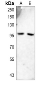 Progesterone Receptor Rabbit Monoclonal Antibody