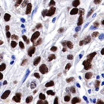 Progesterone Receptor Rabbit Monoclonal Antibody