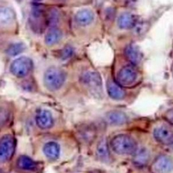 PI3K p110 alpha Rabbit Monoclonal Antibody