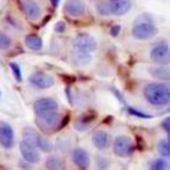Girdin (Phospho-Y1765) Rabbit Monoclonal Antibody