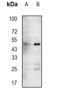 PDK1 Rabbit Monoclonal Antibody