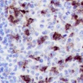 CD279 Rabbit Monoclonal Antibody