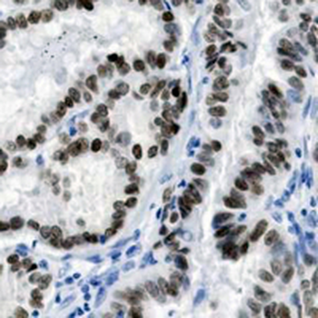 PAX8 Rabbit Monoclonal Antibody