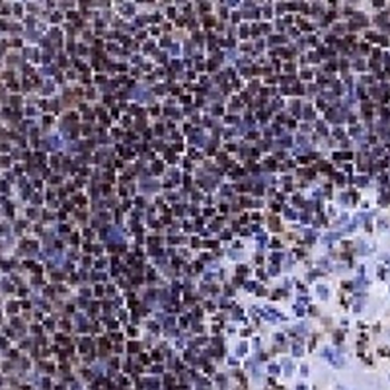 PAX5 Rabbit Monoclonal Antibody