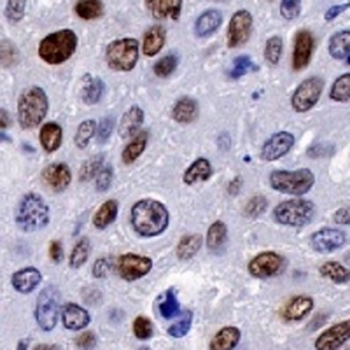 p14 ARF Rabbit Monoclonal Antibody