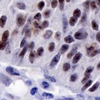 Nucleophosmin Rabbit Monoclonal Antibody