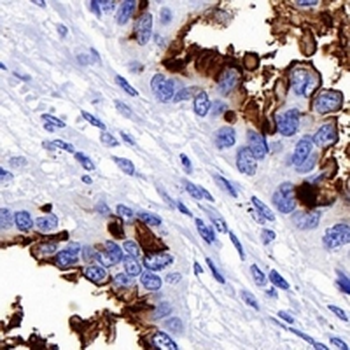 NaPi-2b Rabbit Monoclonal Antibody