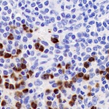 Myeloperoxidase Rabbit Monoclonal Antibody