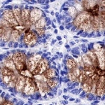 MUC4 Rabbit Monoclonal Antibody