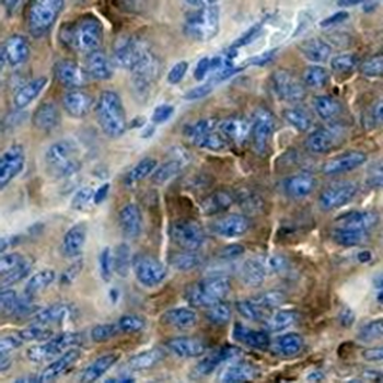 Mesothelin Rabbit Monoclonal Antibody