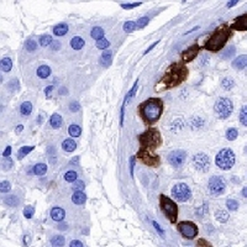 MAGEA1 Rabbit Monoclonal Antibody