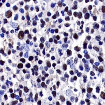LMO2 Rabbit Monoclonal Antibody
