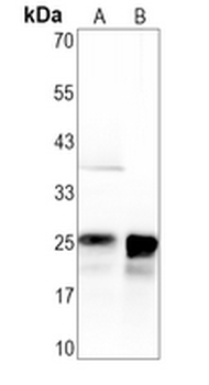 Lambda Light Chain Rabbit Monoclonal Antibody