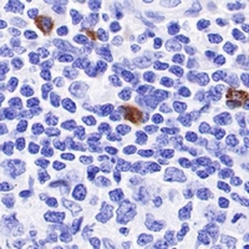 Lambda Light Chain Rabbit Monoclonal Antibody
