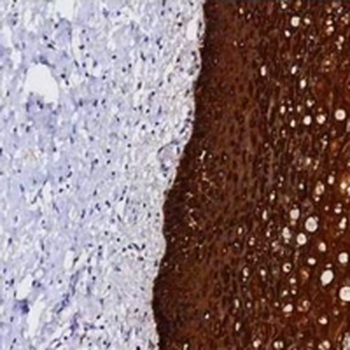 Cytokeratin 5 Rabbit Monoclonal Antibody