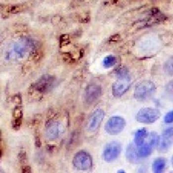Cytokeratin 4 Rabbit Monoclonal Antibody