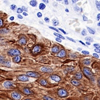 Cytokeratin 17 Rabbit Monoclonal Antibody