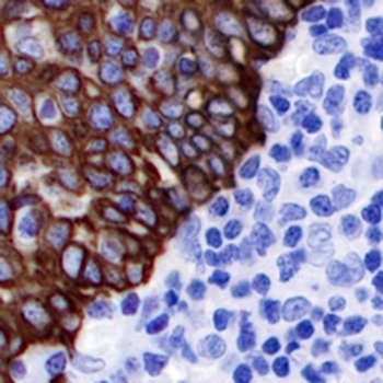 Cytokeratin 14 Rabbit Monoclonal Antibody