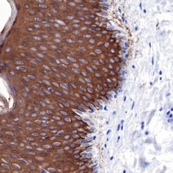 Cytokeratin 10 Rabbit Monoclonal Antibody