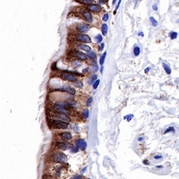 iNOS Rabbit Monoclonal Antibody