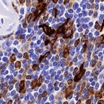 HLA-DPB1 Rabbit Monoclonal Antibody