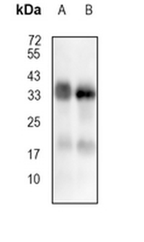 HLA-DP Rabbit Monoclonal Antibody