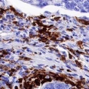 HLA-DP Rabbit Monoclonal Antibody