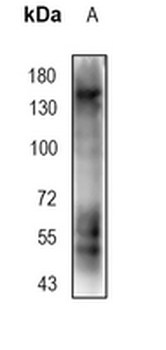 ENT1 Rabbit Monoclonal Antibody