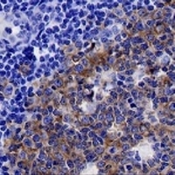 ENT1 Rabbit Monoclonal Antibody