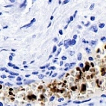 Hemoglobin alpha Rabbit Monoclonal Antibody