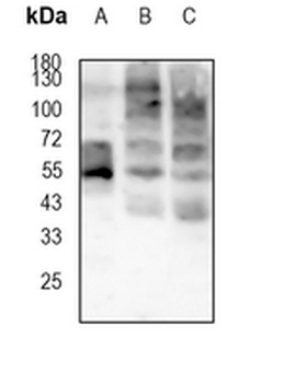 GLUT1 Rabbit Monoclonal Antibody