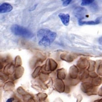 GLUT1 Rabbit Monoclonal Antibody