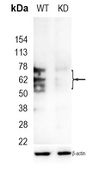 GLUT1 Rabbit Monoclonal Antibody