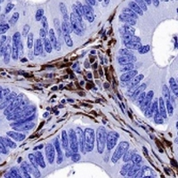Galectin 1 Rabbit Monoclonal Antibody